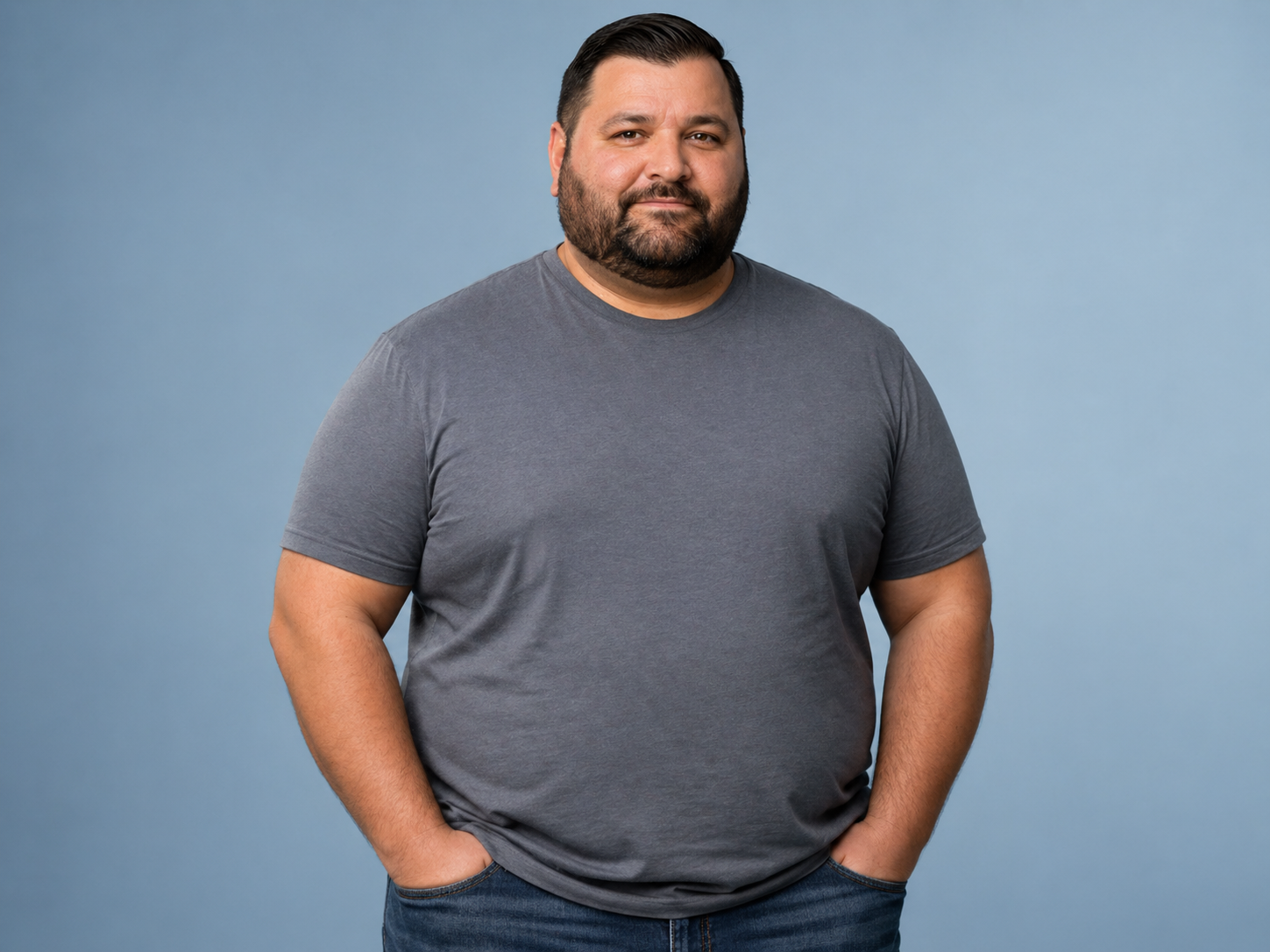 Before bariatric surgery — overweight person